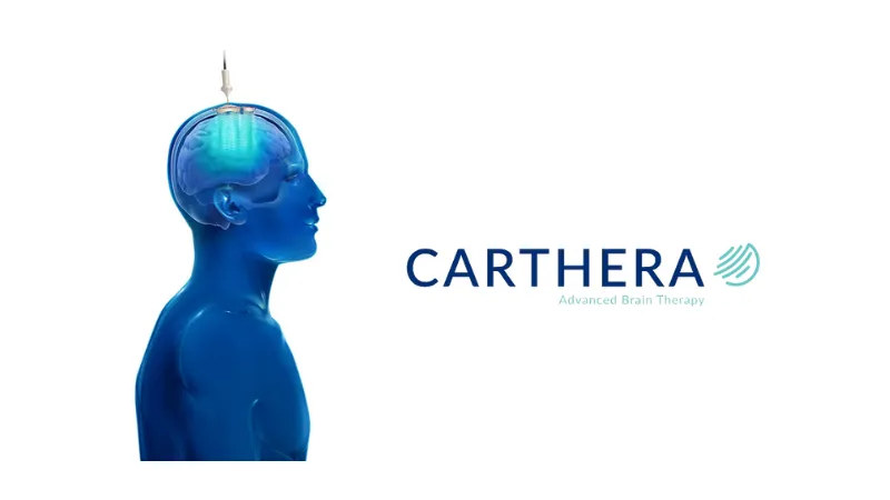 Carthera, a Medtech startup, secures an additional €4.5 million to supplement its Series B investment round, totaling €42 million.
